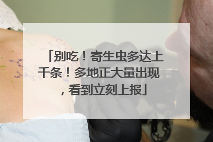 别吃！寄生虫多达上千条！多地正大量出现，看到立刻上报